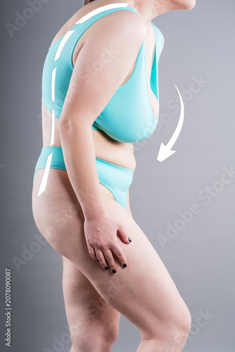 Quadro su tela Bad posture, spine curvature and heavy breast burden concept