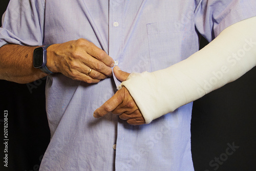 Person struggling buttoning shirt with broken arm cast