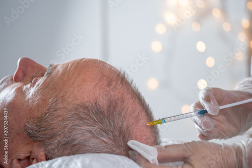 trichologist performs scalp injections vitamins, peptides and amino acids on man's balding area, promoting hair growth, targeting follicle strength and hair restoration
