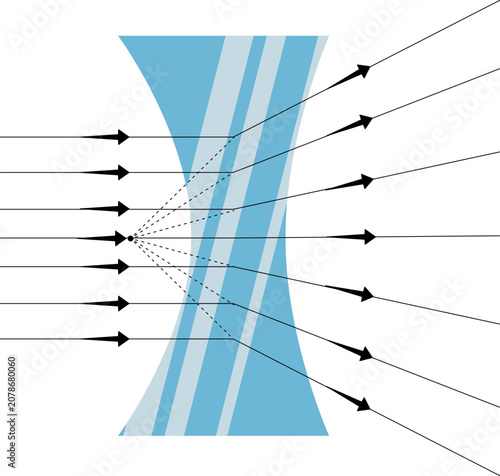 a concave lens (diverging lens), which causes parallel light rays to spread out (diverge) after passing through it, with the virtual focus point indicated by dashed lines.