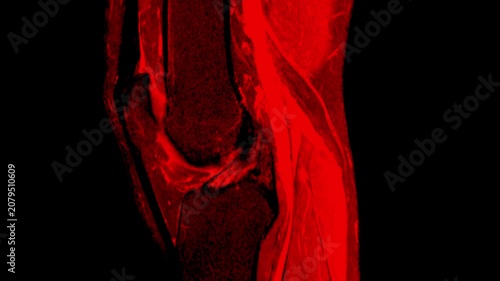 MRI Scan of Right Knee Joint in Red Color Medical Imaging Animation