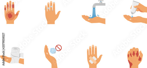 Konstfotografi First Aid Guide Icon Set for Hand Burn Injuries and Skin Wound Care Treatment In