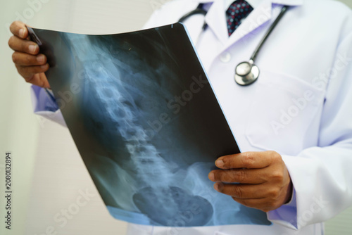 Doctor examining spine bone radiography xray film.