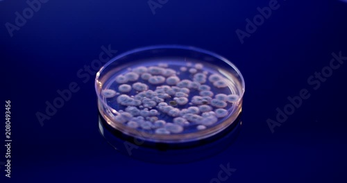 Close up of a petri dish containing a biological sample with multiple circular bacterial colonies