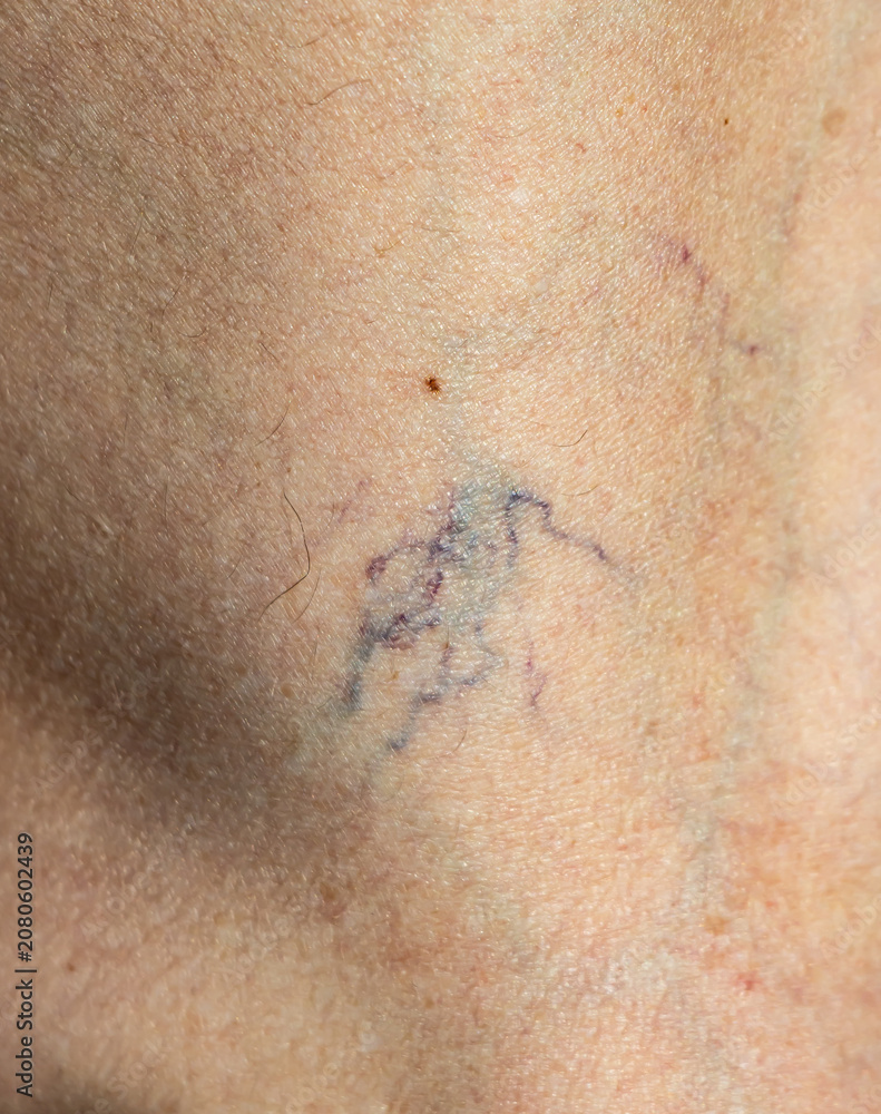 Fototapeta premium Blurry blue ink mark on human skin