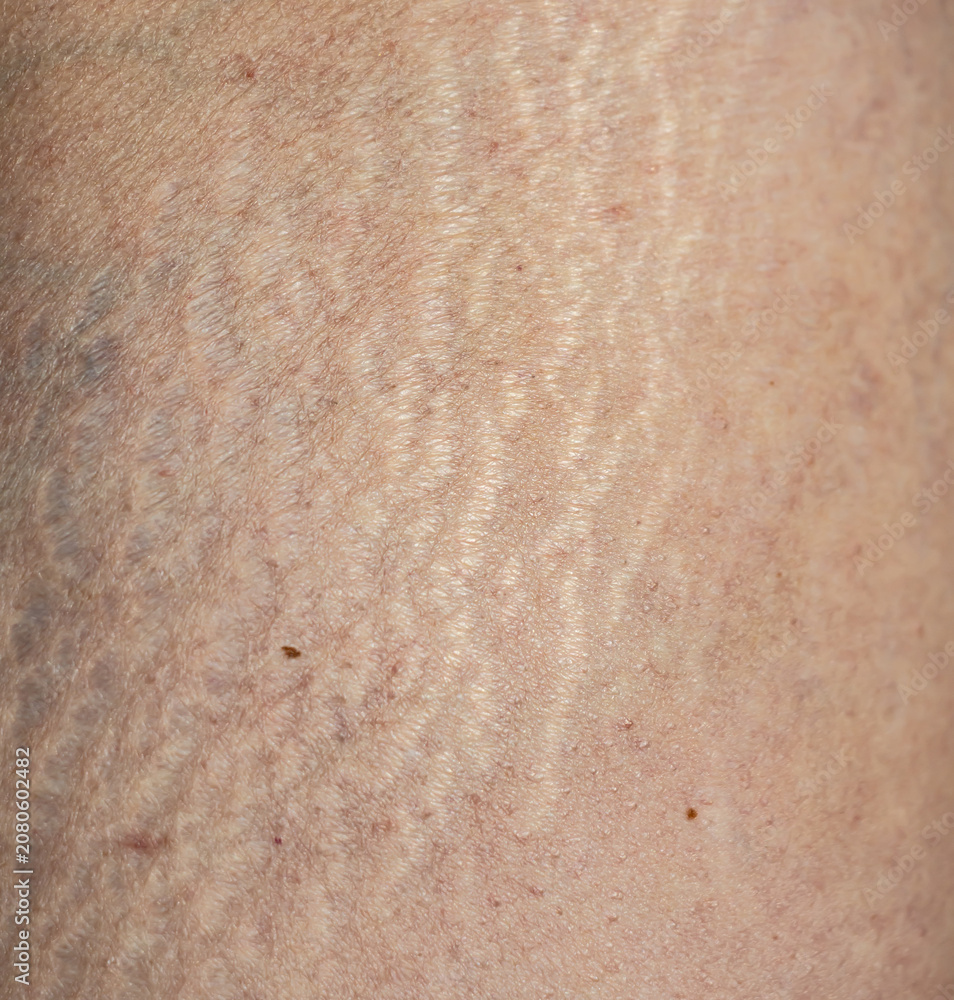 Fototapeta premium Close-up of human skin with visible texture and fine lines