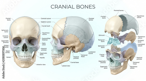 Detailed educational medical diagram showing the anatomy of human cranial bones with labels for frontal parietal and occipital skull sections