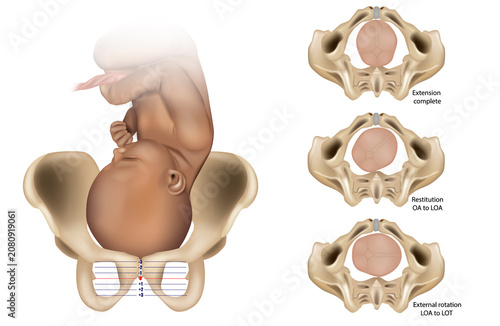 Bild auf Leinwand Anatomical maternal pelvis, fetal position, and fetal station reference