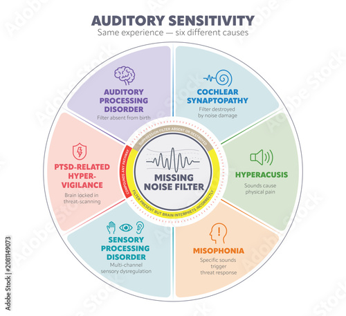 Auditory sensitivity infographic focusing missing noise filter different causes. Including APD, cochlear synaptopathy, hyperacusis, misophonia, sensory processing disorder and PTSD. Vector graphic.