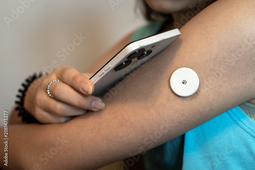 Teenage girl looking at her smartphone screen to monitor glucose levels using a health app. A white sensor patch is visible on her upper arm. Diabetes management, health technology, and telemedicine