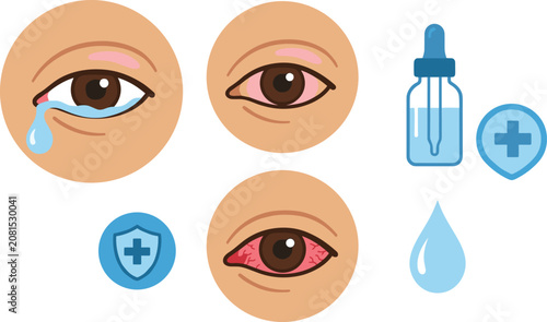 Foto Eye irritation treatment medical vector set featuring watery eye crying red infl