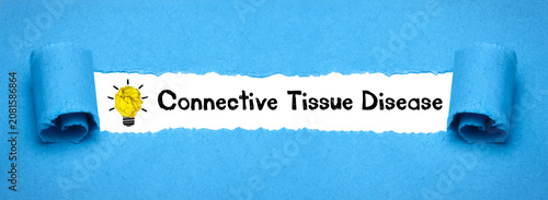 Εκτύπωση καμβά Connective Tissue Disease