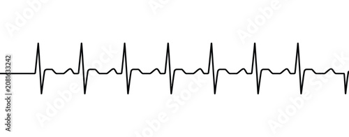 Cuadro en lienzo Electrocardiogram reading shows normal heartbeat rhythm medical ECG line graph d