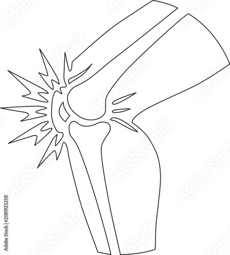 Obraz na płótnie Broken elbow joint line drawing with impact lines white background