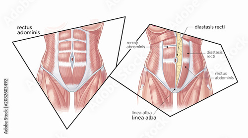 Abdominal muscle anatomy, rectus abdominis and linea alba