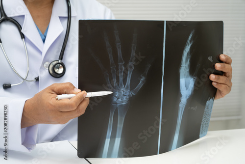 Doctor examining hand ankle joint bone radiography xray film.
