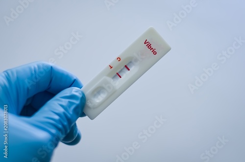 The sample of patient positive result for vibrio.