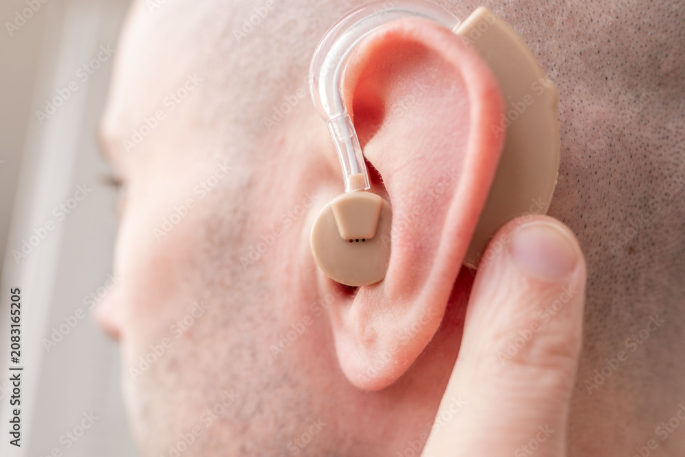 Fototapeta premium Young man with beige hearing aid in ear, close up portrait, BTE hearing support, accessibility, modern technology, inclusion, health care, confidence and everyday life, Modern healthcare solutions