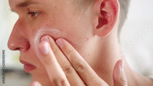 Man applying medicated cream to acne blemishes on his cheek. Skin care treatment for men. Close up of a person applying lotion to moisturize bad skin. Curing acne. Medical treatment of skin.
