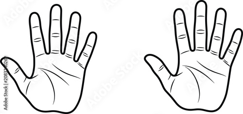 Quadro em tela Human Hands with Six Fingers Polydactyly Medical Condition Outline Vector Illust