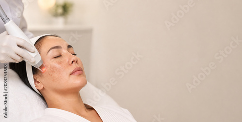 Melasma treatment in a clinical spa setting, with laser skincare procedure and a relaxed patient portrait for beauty, dermatology, and wellness use.
