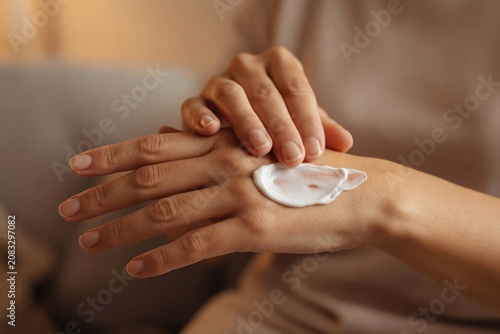 Woman applying cream to hand. Skincare routine and daily body care concept for sensitive skin. Treating dry skin, eczema or psoriasis symptoms related to autoimmune condition or hormonal change.