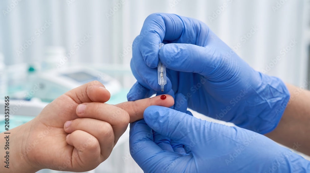 Fototapeta premium A health worker in blue gloves performs a finger prick on a child's hand to collect a blood sample in a clinic. The child sits calmly during the routine check-up