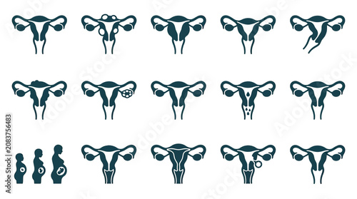 Uterus Health Conditions and Pregnancy Stages Icons Set