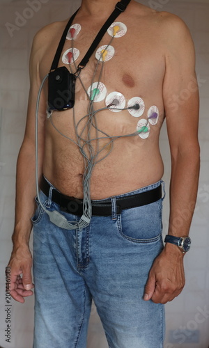 Close-up of an adult man wearing a portable Holter ECG monitor with multiple adhesive electrodes attached to the chest.