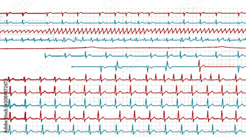 Foto Medical ECG heart rate monitor waves, red and blue electrocardiogram lines on gr