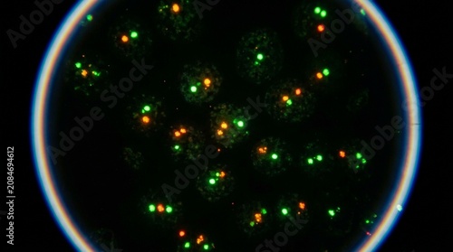 Fluorescence in-situ hybridization slide viewed under a fluorescence microscope
