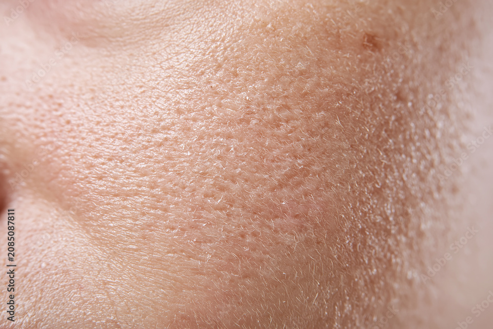 Fototapeta premium Close up macro of slightly dry facial skin with visible pores, fine vellus hair and subtle flaking, warm natural tone conveying texture and gentle skin dryness