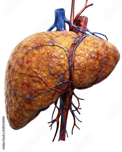Detailed 3D human liver anatomy model with arteries and veins affected by fatty liver disease on black background