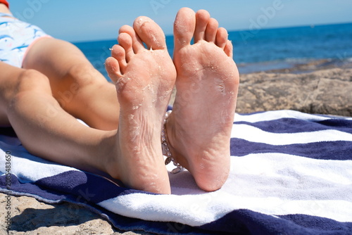 фотографія Woman's peeling feet and sunburnt skin relaxing on a striped towel at the beach
