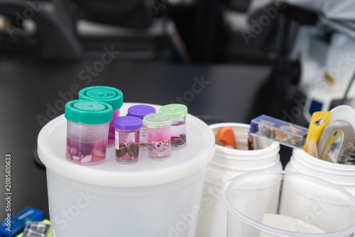Fotografía Preserving tissue samples in formalin for pathology examination