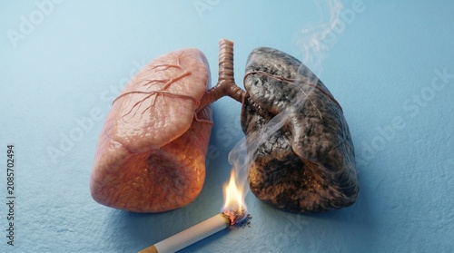 Comparison of healthy lungs and damaged smoker lungs on a light background, respiratory education, pulmonary care, medical science