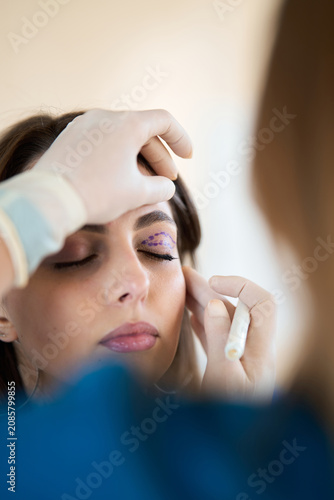 Photos Plastic surgeon performs preoperative eyelid marking on a woman to plan the inci