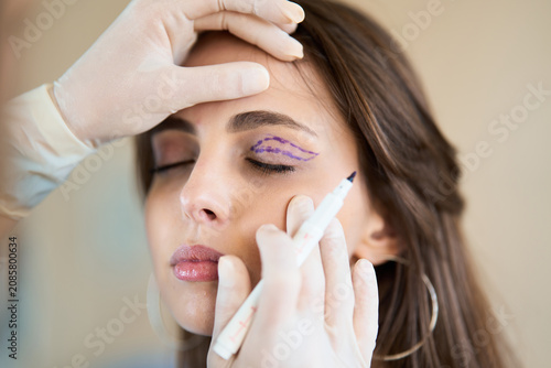 Fotografie Professional surgeon marks the upper eyelid of a woman with a medical pen to map