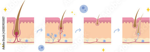 Bild auf Leinwand Human Hair Growth Cycle Diagram Vector Set Showing Anagen Catagen Telogen and Ex