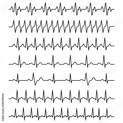 Bild auf Leinwand A large set of linear electrocardiogram graphs with different types of heart rhythms