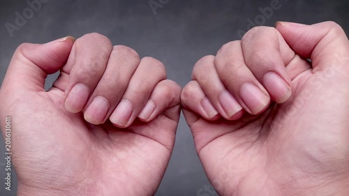 Close up detail of a woman's hand showing long, uncut, dry, and dirty fingernails, isolated on gray background.