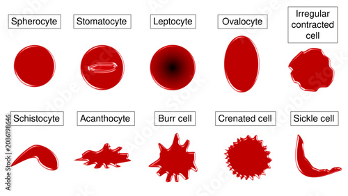 Foto Abnormal Red Blood Cell Morphology Diagram