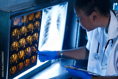Female medical radiologist doctor looking head and brain x-ray film before surgery in lab office at hospital. Healthcare and education.