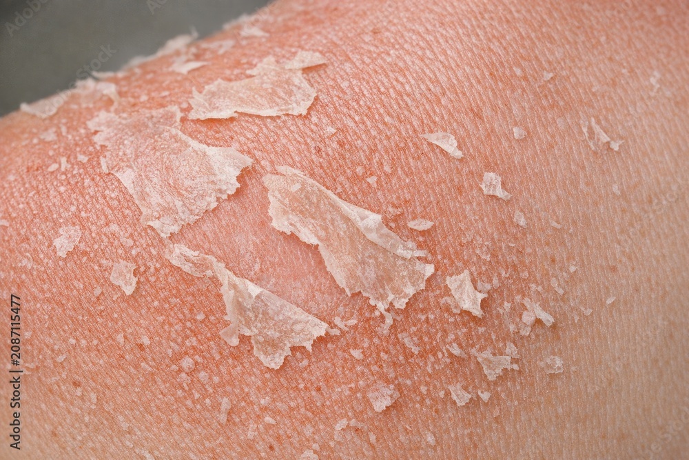 Fototapeta premium A close-up shot of a person's arm featuring a visible skin patch, suitable for use in medical or health-related contexts