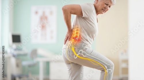 Senior woman suffering from sciatica with a 3D anatomical overlay of nerve compression. Elderly female patient showing sciatic nerve pain in the lumbar spine. Medical healthcare diagnostic concept