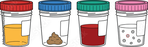Photos Medical laboratory specimen cups collection containing urine stool blood and sem