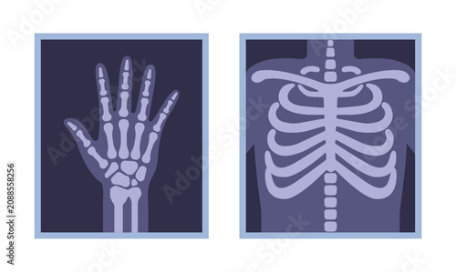 Foto Digital illustration displaying a purple x-ray of a human hand and a rib cage, highlighting bones and skeletal structure