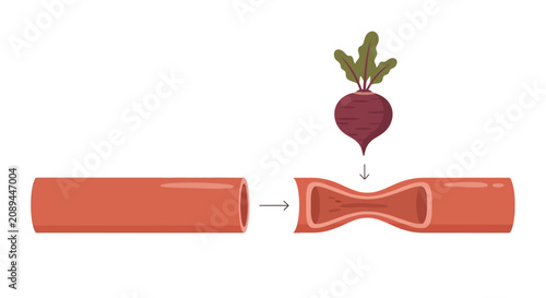 Beetroot Juice Improves Blood Vessel Health, Reduces Arterial Plaque and Blood Flow Obstruction