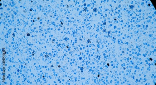 Microscopic view of stained human smear showing numerous red cells and scattered dark blue stained leukocytes