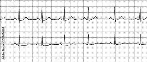 Bild auf Leinwand Electrocardiogram ECG strip isolated on transparent background.